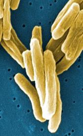 Imagen de la tuberculosis