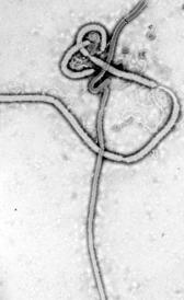 Imagen del ébola